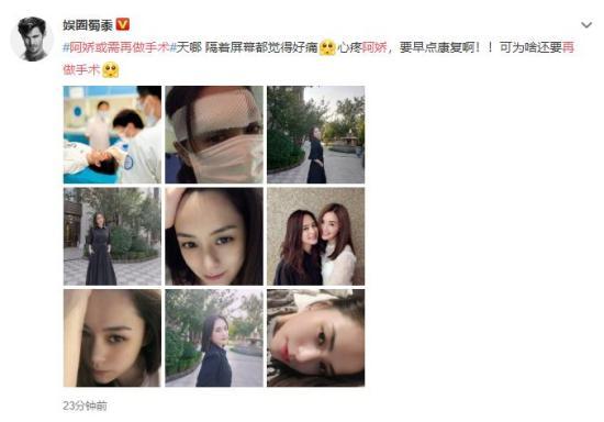 阿娇或需再做手术 隔着屏幕都觉得很疼！！