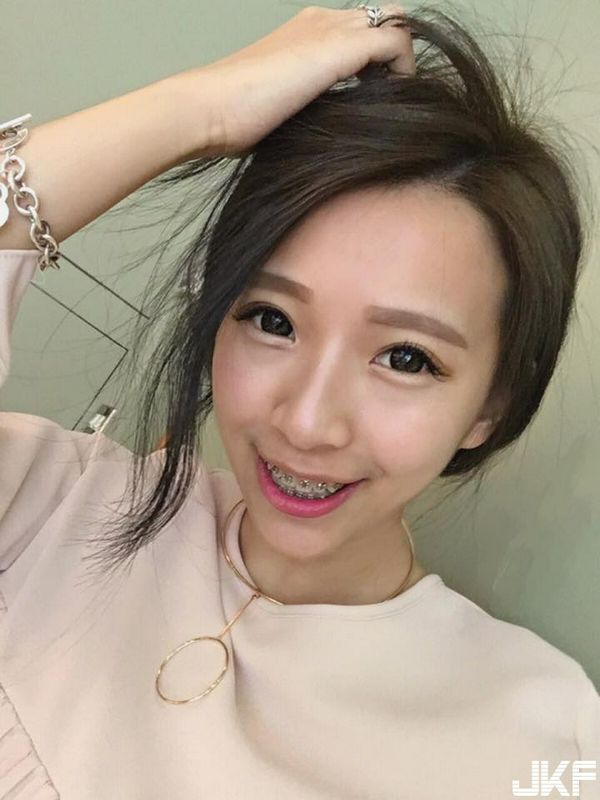 曾念花开南超可爱正妹！就算戴了牙套依旧动人